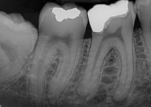 dental audit